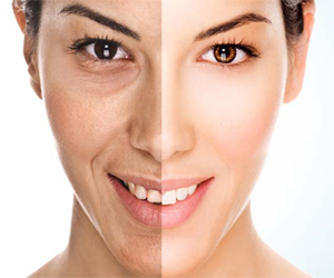 Anti-Aging Cilt Bakımı